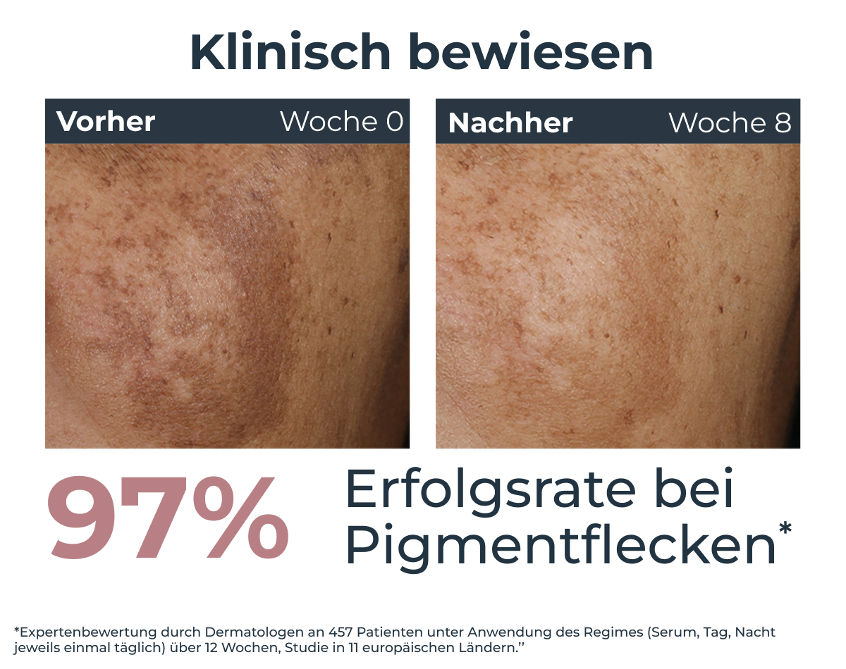 Eucerin